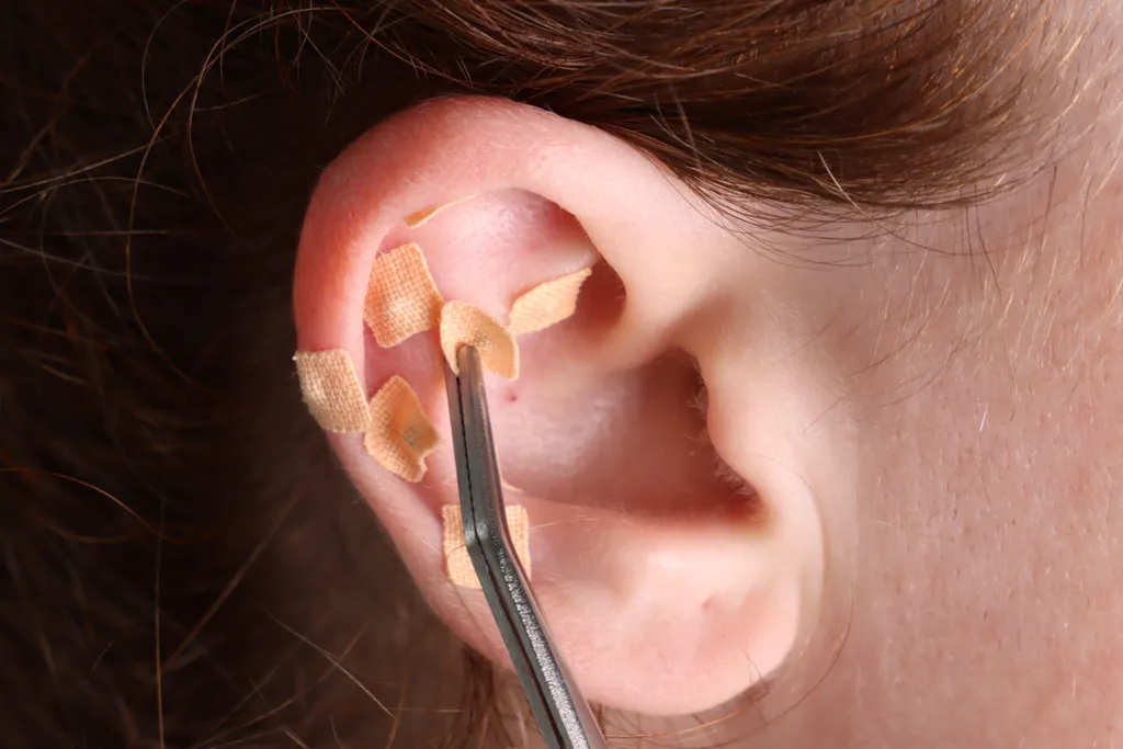 ear seeding